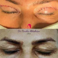 جراحی زیبایی پلک بینی ژل بوتاکس جوانسازی