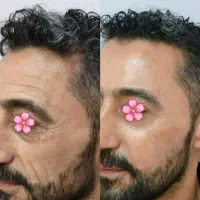 صابون روشن کننده پوست و بدن بدون بازگشت