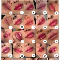 شگفتانه قیمت فیلر و بوتاکس فقط تا پایان هفته