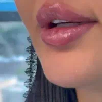ژل (فیلر)،بوتاکس،آنزیم