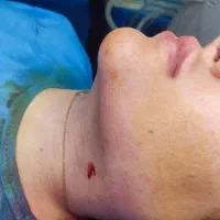 لیپوساکشن ،پیکرتراشی، جراحی زیبایی ،ابدومینوپلاستی|خدمات آرایشگری و زیبایی|تهران, شهرآرا|دیوار