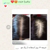 تونیک تقویت ورشد مو