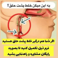 خلط پشت حلق