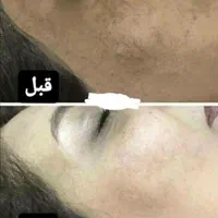 کرم معجزه صابون صندل ۱۲۵گرمی|آرایشی، بهداشتی، درمانی|ورامین, ورامین|دیوار