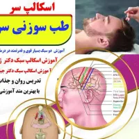 آموزش طب سوزنی اسکالپ سر