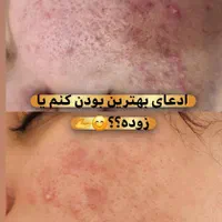 پاکسازی و درمان پوست
