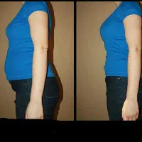 لاغری فقط در۵جلسه با rfکویتیشن و لیپولیزبا۱۹۰هزار