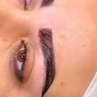 کاشت مو وابروی تخصصی با تکنیک نانوسل|خدمات زیبایی و سلامت|تهران, نیلوفر|دیوار