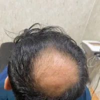 به تعدادی مدل با موی کم پشت نیازمندیم