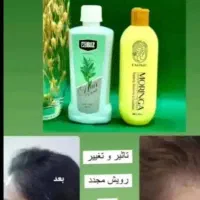 باریزش موهات خداحافظی کنی|آرایشی، بهداشتی، درمانی|گرمسار, |دیوار