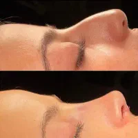جشنواره استثنایی  جراحی زیبایی تا آخر شهریور|خدمات آرایشگری و زیبایی|تهران, جنت‌آباد مرکزی|دیوار