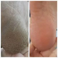 تخفیف ویژه خدمات ناخن و اسپا|خدمات آرایشگری و زیبایی|شیراز, فرگاز|دیوار