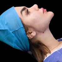 ساکشن غبغب بلفارو کاشت ابرو بوکال فت|خدمات آرایشگری و زیبایی|تهران, میرداماد|دیوار