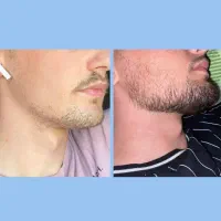 ریشای پرپشت دلیل داره