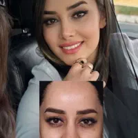 جشنواره بهاره عمل بینی