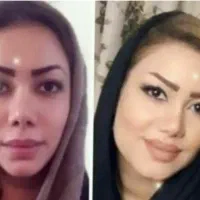 میخوای تپل شی بدون ژل و بوتاکس