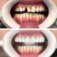 دندانپزشکی با اقساط 2 ساله بدون پیش پرداخت
