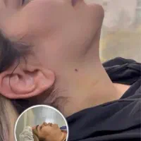 جراحی زیبایی با قیمت فوق العاده مناسب|خدمات آرایشگری و زیبایی|ساری, |دیوار