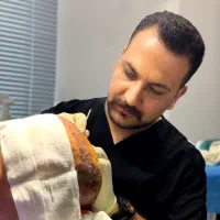 کاشت مو،ریش و ابرو در شیراز و رشت