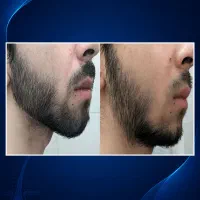 مثل گلادیاتورها ریش بزار