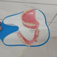 پروتز متحرک دندان|آرایشی، بهداشتی، درمانی|گنبد کاووس, |دیوار