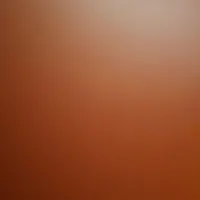 کیف پول گمشده