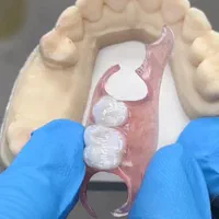 جشنواره مرکزدست دندان وساخت دندانهای مصنوعی ژلهای|خدمات آرایشگری و زیبایی|کرج, مطهری|دیوار