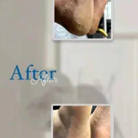 خدمات اسپا در قشم