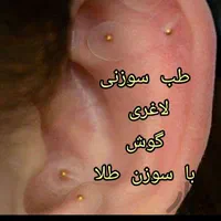 حجامت.زالو.نیدل لاغری.بواسیر.یون تراپی یا سم زدایی|خدمات آرایشگری و زیبایی|مشهد, توس (بلوار توس)|دیوار