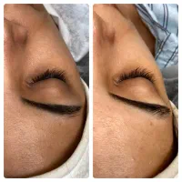 فیشیال و پاکسازی پوست و زیبایی