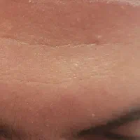 خدمات زیبایی بوتاکس و فیلرو جوانسازی