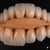(دندانسازی )استخدام پودرگذار دور کار