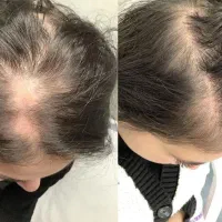این اخرین روشیه که امتحان میکنی