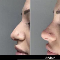 اقساطی/کاشت مو تضمینی/کاشت ابرو/ژل لب|خدمات آرایشگری و زیبایی|سنندج, |دیوار