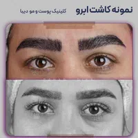 (+فیلم) کلینیک کاشت مو، ابرو و ریش|خدمات آرایشگری و زیبایی|تهران, صادقیه|دیوار