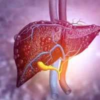 طب درمانی،پاکسازی کبد،اصلاح مزاج با طب سنتی