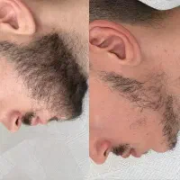 درمان ۳۰ روزه با ما