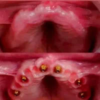 مرکز تخصصی دندان پزشکی و ایمپلنت مختص افراد حساس|خدمات زیبایی و سلامت|تبریز, |دیوار