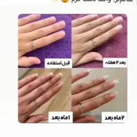 ناخنت میشکنه بیا برات درستش کنم|آرایشی، بهداشتی، درمانی|تیران, |دیوار