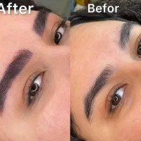 میکروبلیدینگ ابرو