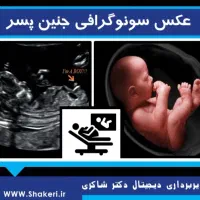 نوبت سونوگرافی کلینیک ولیعصر قیمت سونو 30تومن