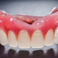 استخدام کاراموز در دندانسازی