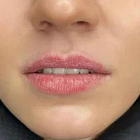 کلینیک لیزر و زیبایی دکتر سرمدی،،خدمات هدیه بگیرید|خدمات آرایشگری و زیبایی|اصفهان, هزارجریب|دیوار