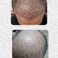 کاشت موطبیعی و پرتراکم تضمینی باهزینه کمتر در یزد