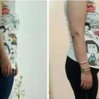 کاهش وزررزن اصولی با مشاوره رایگان|فعالیت داوطلبانه|گنبد کاووس, |دیوار