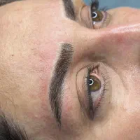 فیبروز ابرو