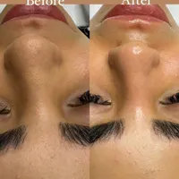 پاکسازی و فیشال تخصصی مشاوره رایگان|خدمات آرایشگری و زیبایی|تهران, حکمت|دیوار