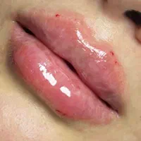 تزریق ژل اصلی ۳۸۰  و بوتاکس فول فیس بانصف قیمت|خدمات آرایشگری و زیبایی|اسلام‌شهر, شهرک واوان|دیوار