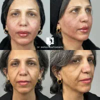 کلینیک زیبایی شیراز