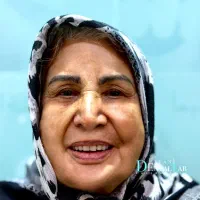 لبخند اختصاصی متناسب با فرم صورت شما